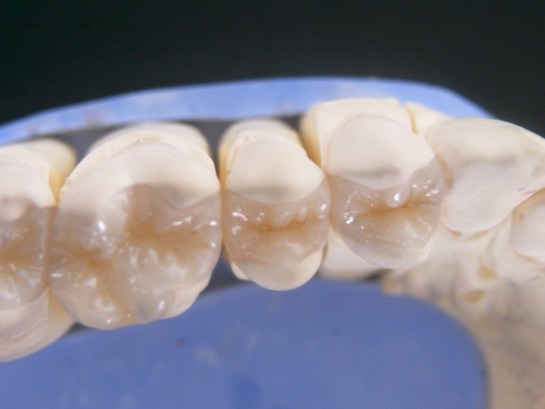 CEREC 2